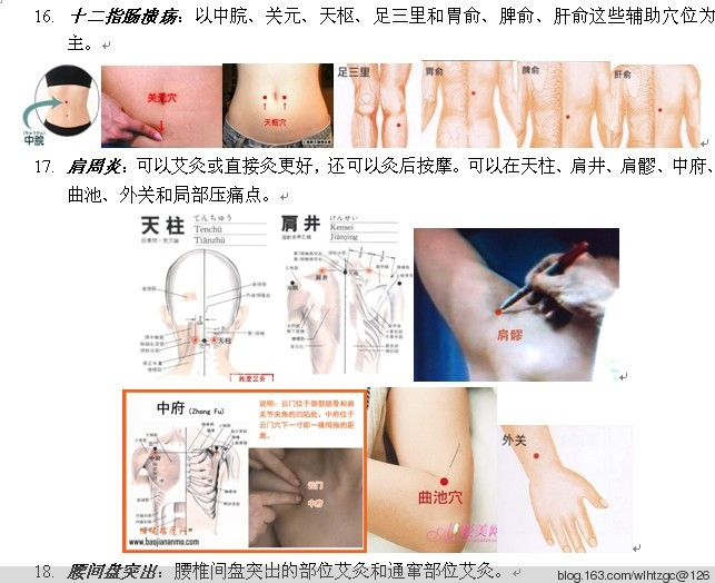 簡單易學(xué)的艾灸 - 養(yǎng)生堂 - 養(yǎng)生堂