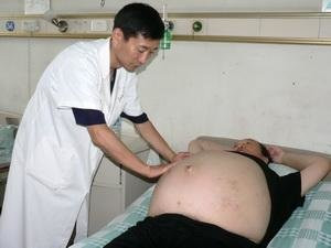 一個可以救命的秘方——腹水貼 - 秋白 - 黑色物語
